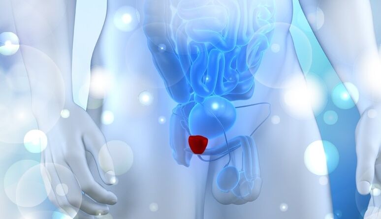 Vesiculita en hombres