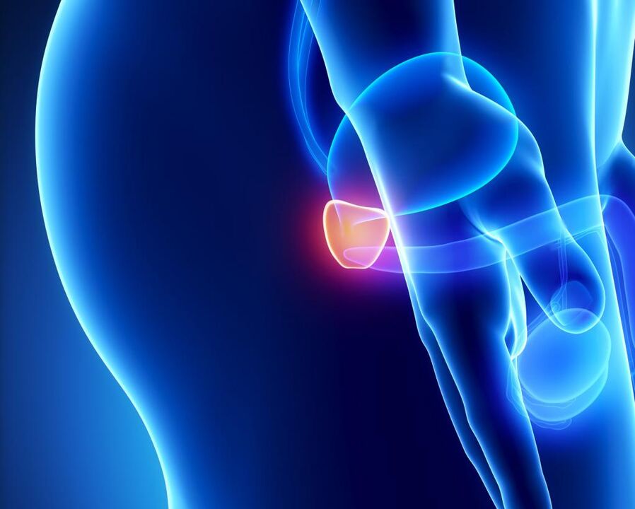 Inflamación de la glándula prostática.